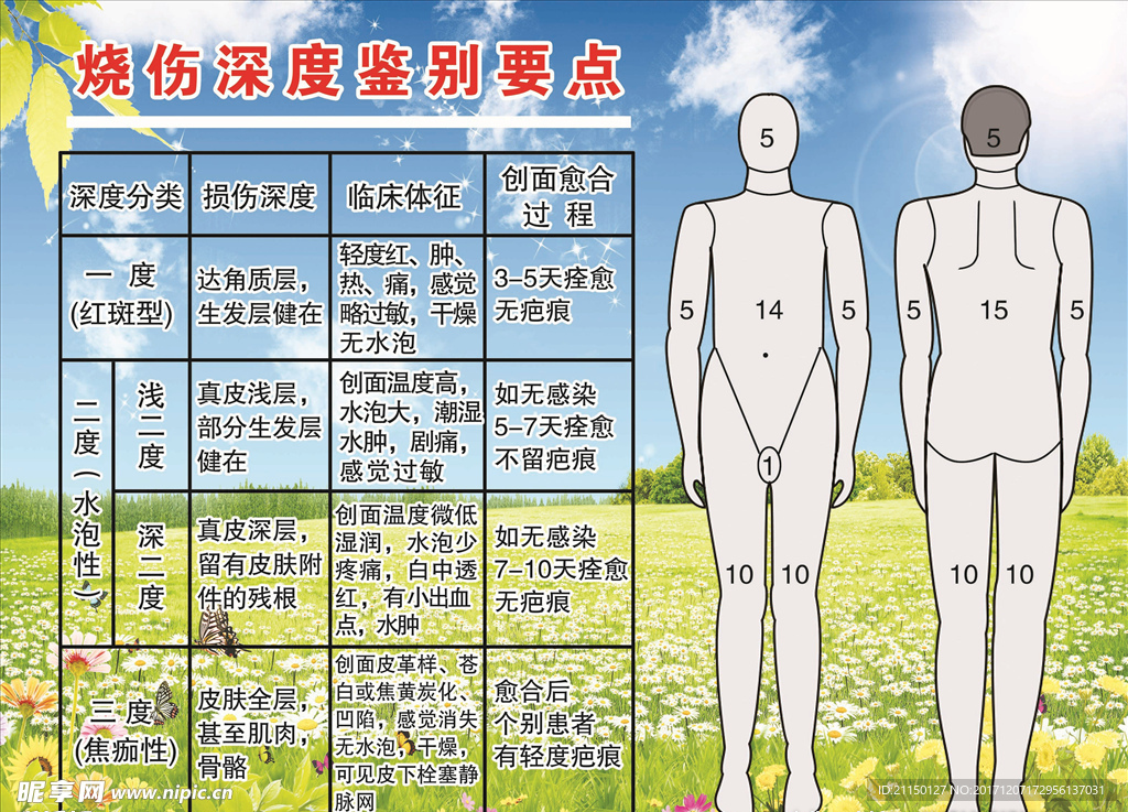 烧伤深度鉴别要点