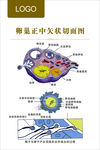 卵巢正中矢状切面图