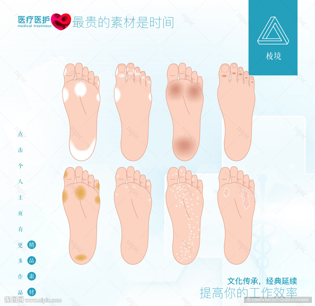 脚气