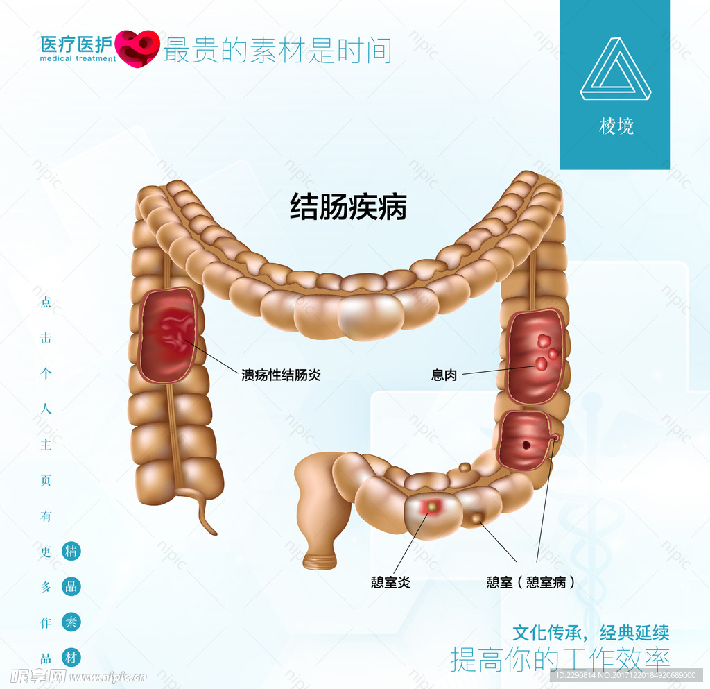 结肠疾病