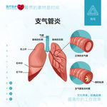 支气管炎