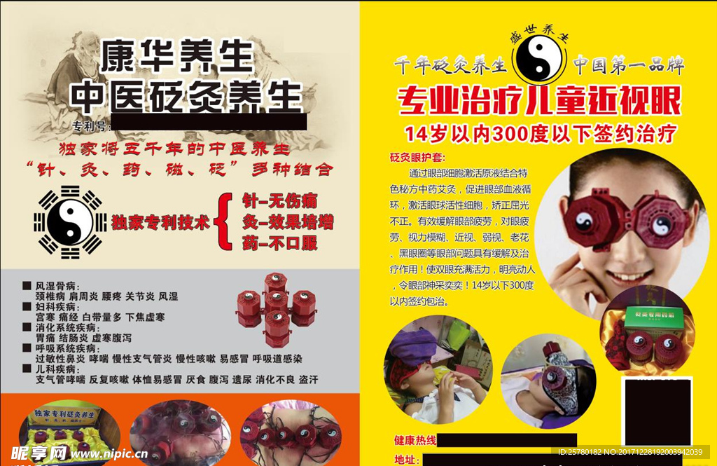 砭灸养生宣传单