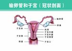 输卵管和子宫 冠状剖面  展板