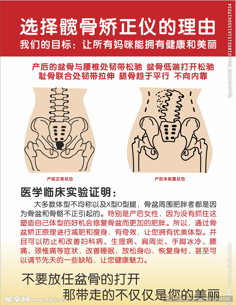 髋骨矫正海报