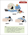 急救 口对口呼吸法