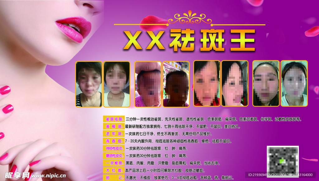 袪斑