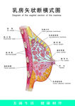 乳房矢状断横式图