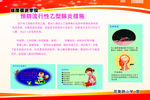 乙型脑炎