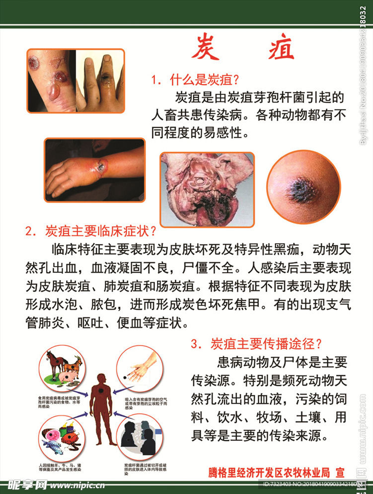 炭疽病宣传海报