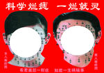 面痣