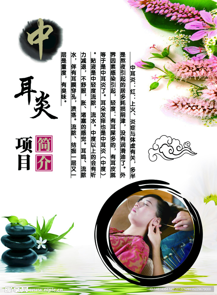 中耳炎