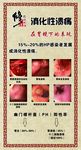 修正广告
