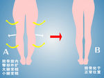 大腿小腿变细
