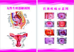 女性生殖宫颈图