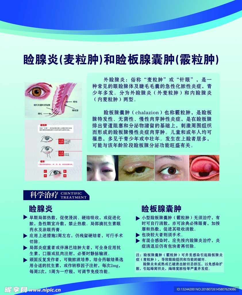 睑腺炎和睑板腺囊肿