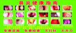 鼻炎内窥镜成像图