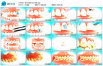 展示牙齿矫正术全过程