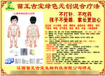 苗王古宝   儿童标准经络穴位