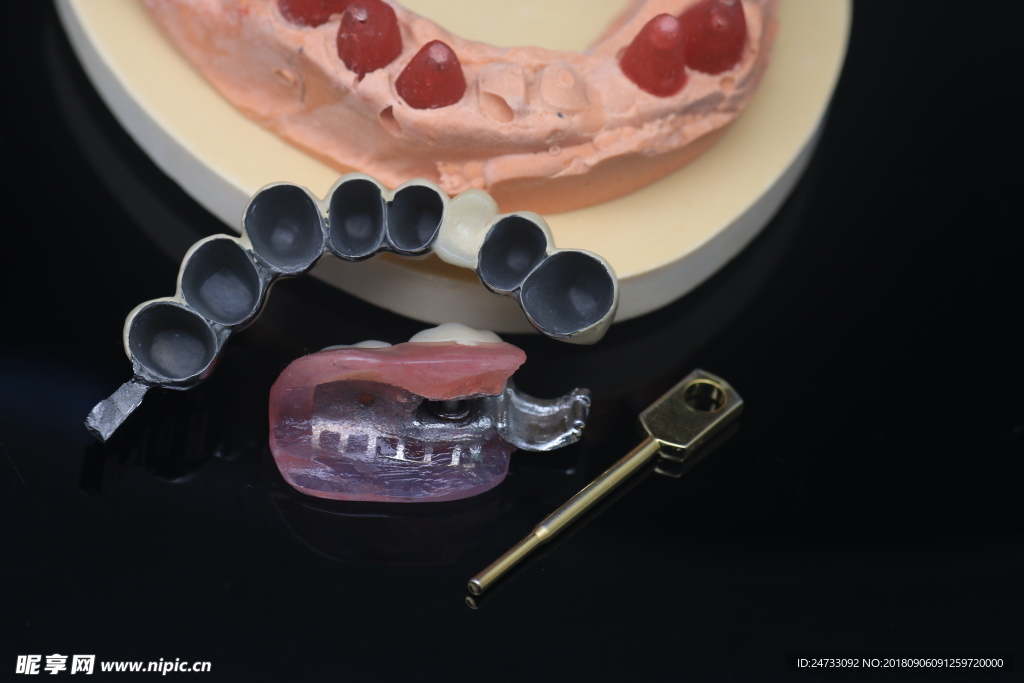 义齿 假牙 精密附件 牙齿 牙