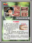 牙科挂画 龋齿
