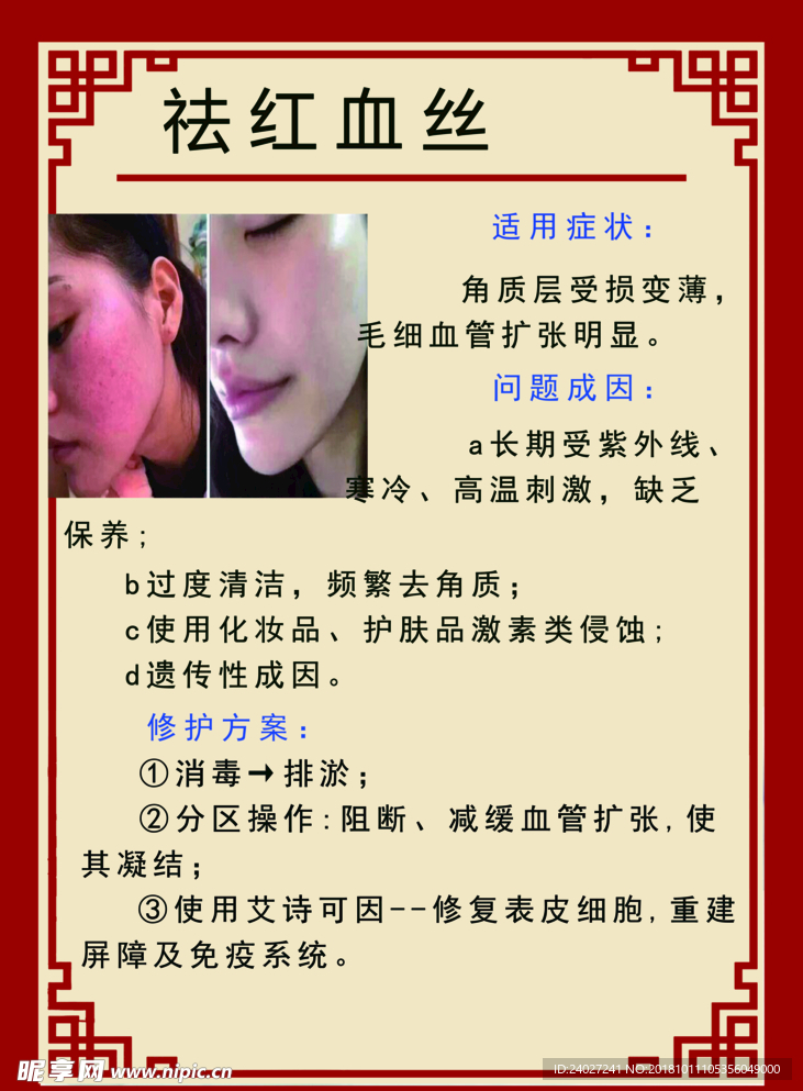 去红血丝