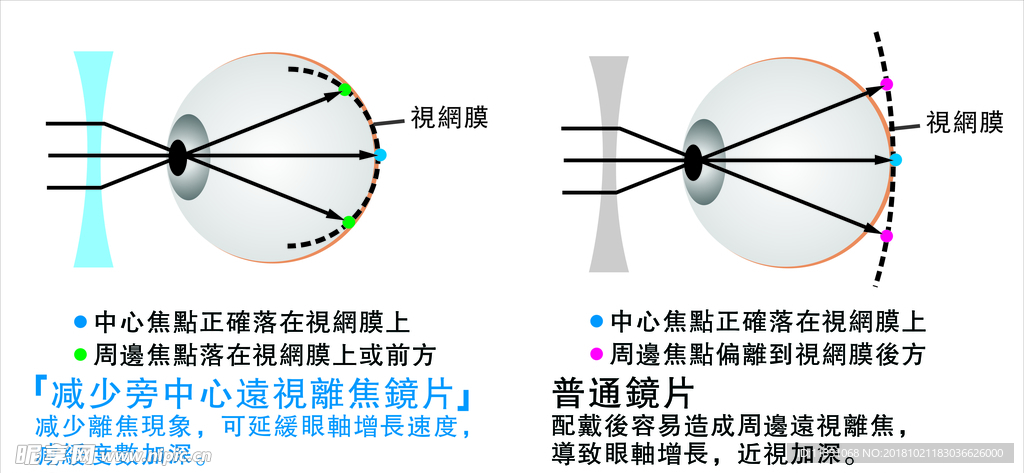 眼球 眼睛 视网膜 视物