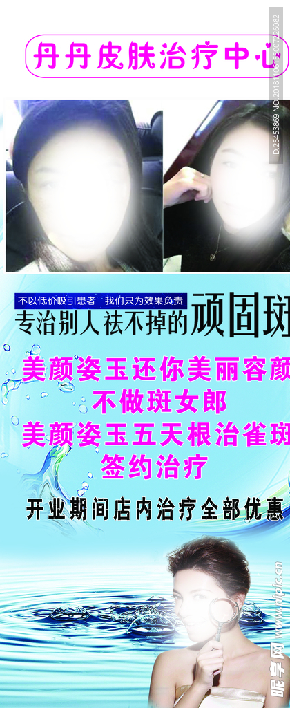 美容 祛斑