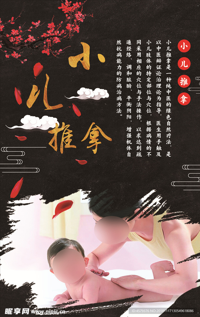 小儿推拿