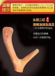 鹿角