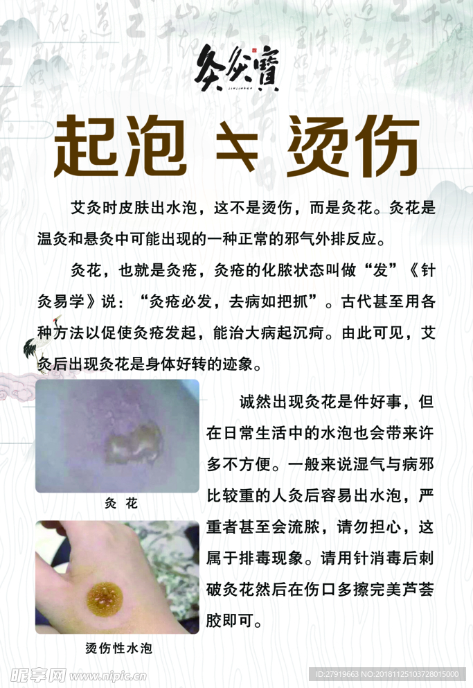 起泡不等于烫伤