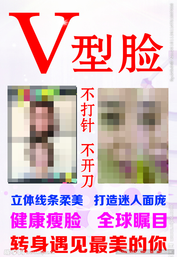 V型脸