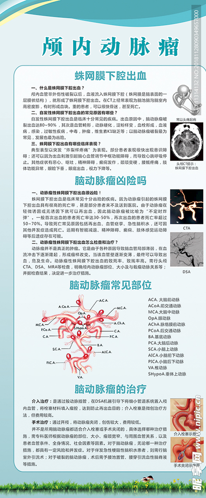 颅内动脉瘤展板