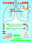 防治结核病