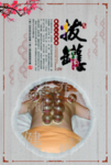 拔罐