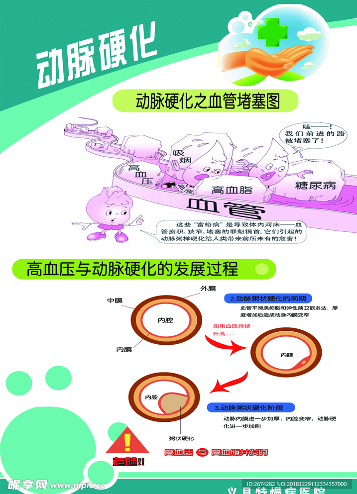 动脉硬化