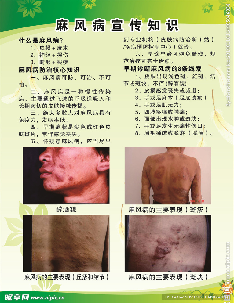 麻风病知识宣传