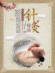 针灸