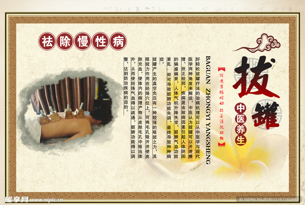 中医拔罐