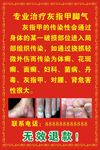 专业治疗灰指甲脚气