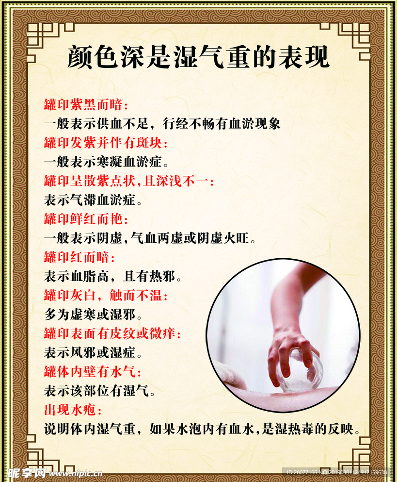 拔罐介绍