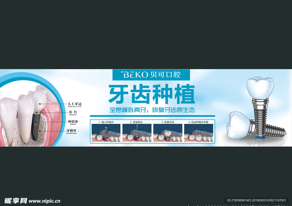 牙科口腔诊所种植牙喷绘网站横幅