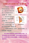 乳腺增生到癌的发展阶段