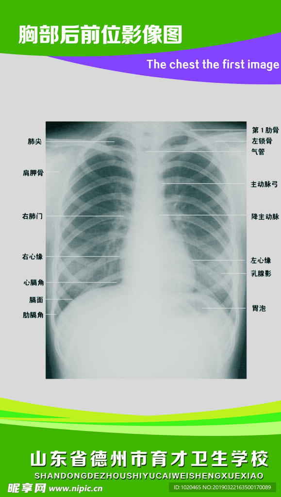 胸部后前位透视图