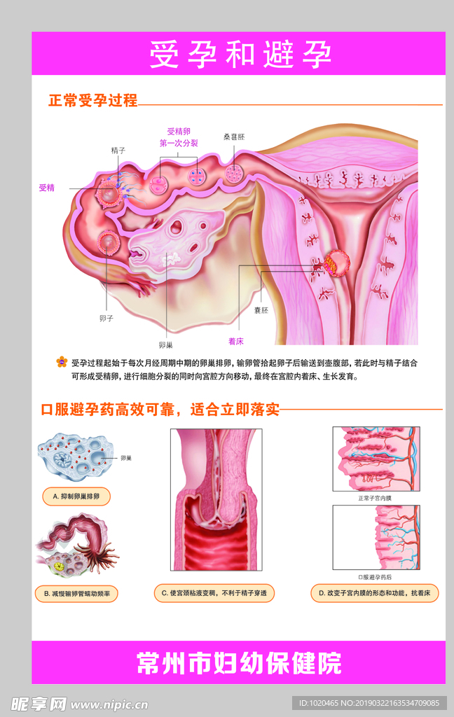 受孕和避孕展板
