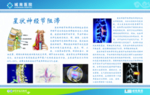 康复理疗