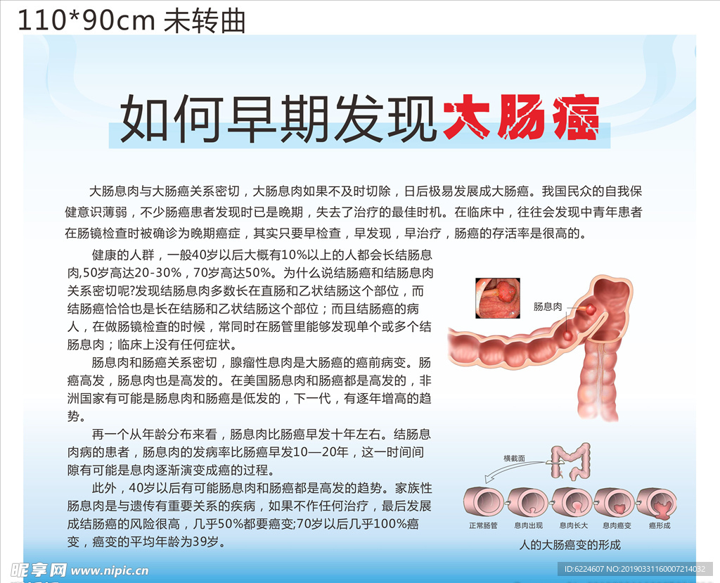 胃肠癌宣传展板大肠癌