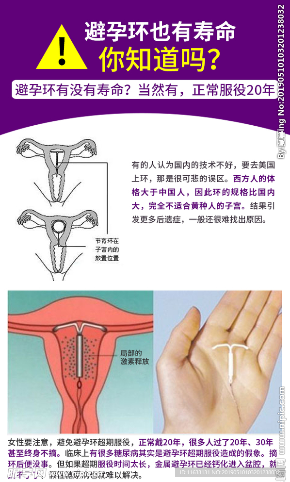 避孕环也有寿命，你知道么？
