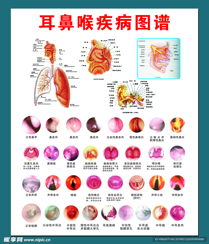 耳鼻喉疾病图