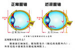 眼轴示意图
