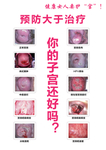 女性宫颈病变